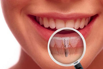 National Dental Accreditation Programme